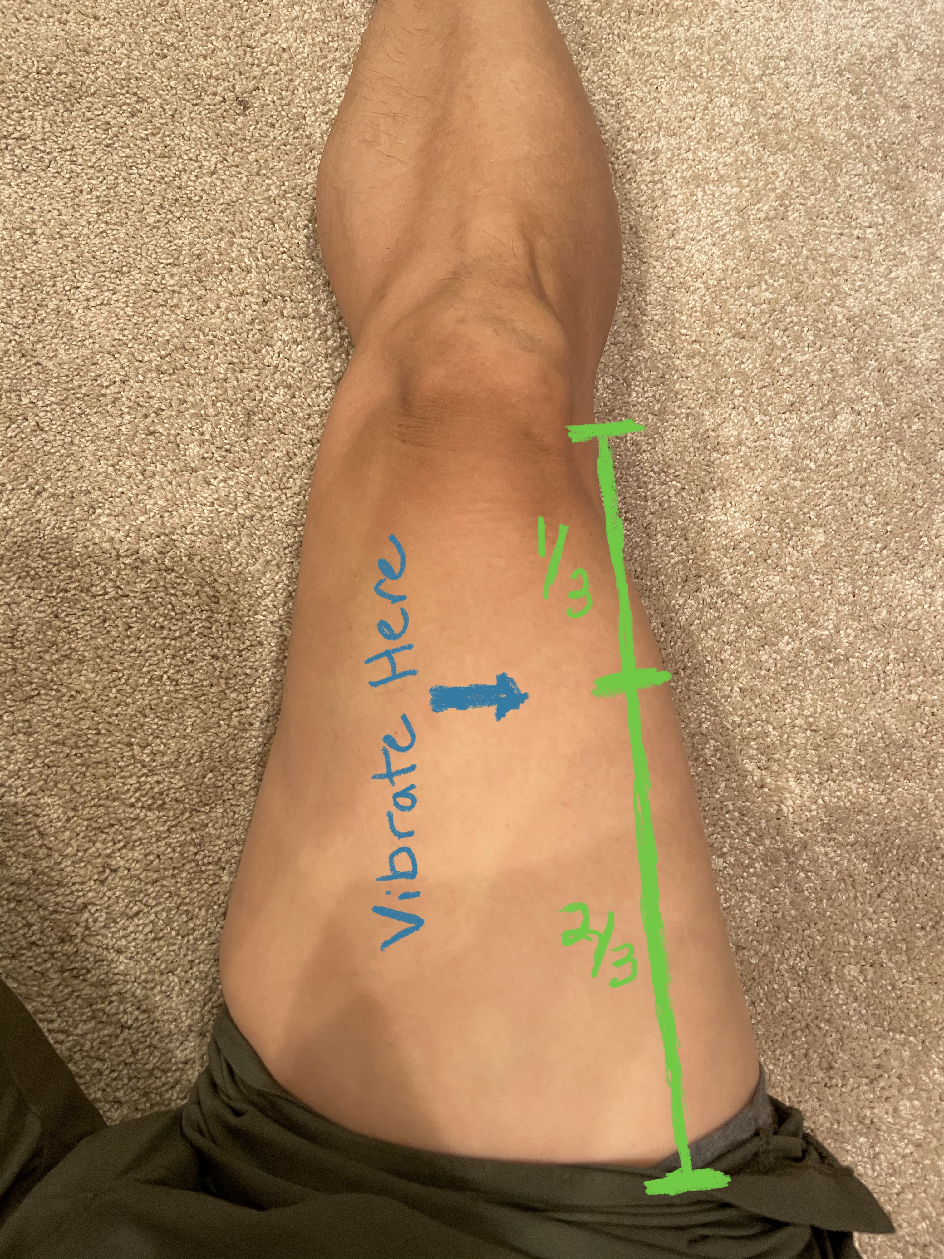 Focus is the Key Focal Vibration Therapy on a Budget JenFu Cheng MD Focus is the Key Focal Vibration Therapy on a Budget JenFu Cheng MD